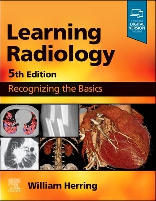 Paperback book titled "Learning Radiology: Recognizing the Basics" by Elsevier, showing the cover with medical imaging graphics.