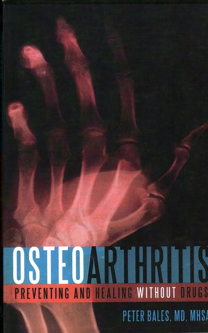 Paperback book titled "Osteoarthritis: Preventing and Healing Without Drugs" by Prometheus Books, featuring a clean cover design.